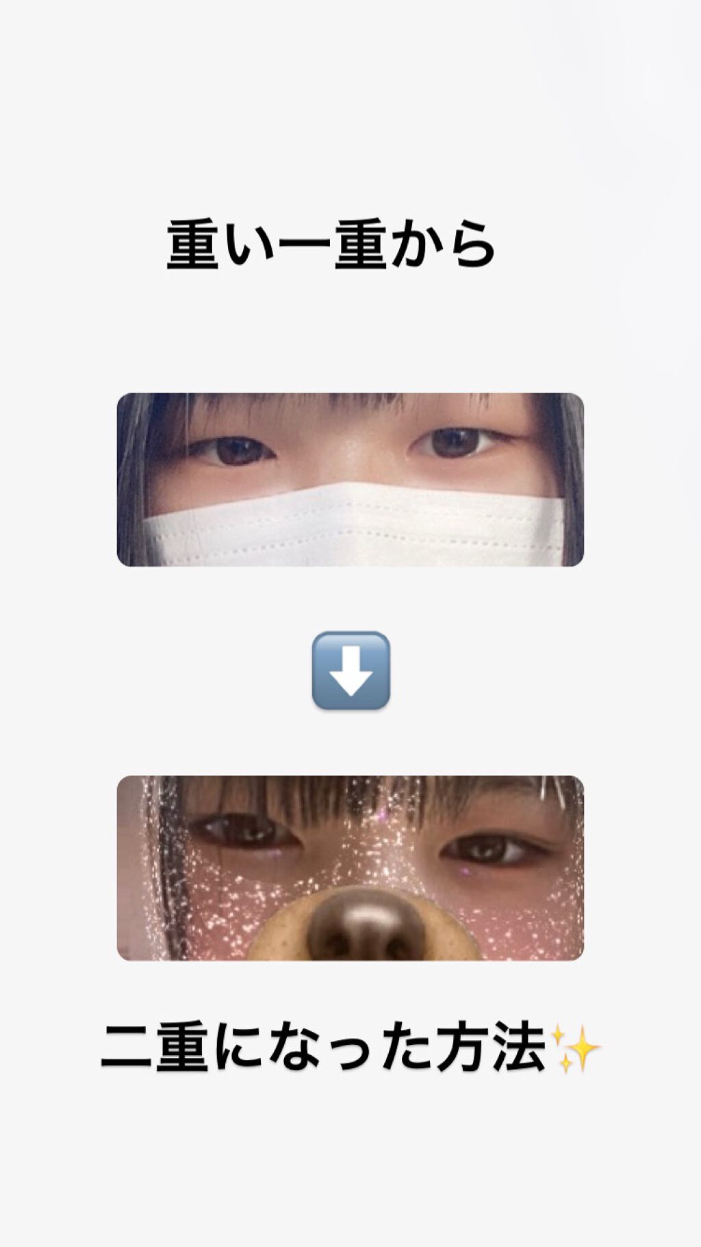 アイテープ片面(のびる)絆創膏タイプ スリム 120枚/セリア/二重まぶた用アイテムを使ったクチコミ(1枚目)