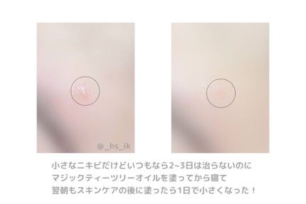 マジックティーツリーオイル/ブラン/フェイスオイルを使ったクチコミ(2枚目)