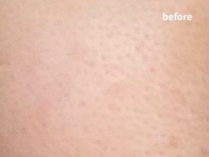 スキンティントセラム/excel/リキッドファンデーションを使ったクチコミ(4枚目)