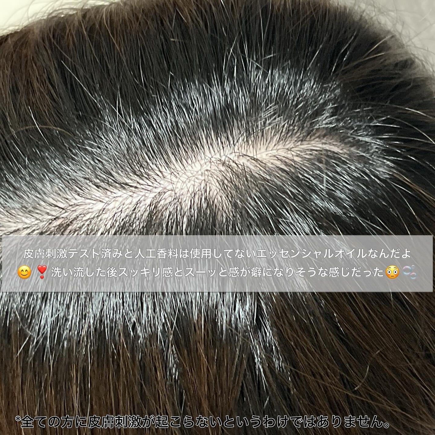 スパークリングスカルプスケーラー/ミンツリー/頭皮ケアを使ったクチコミ(5枚目)