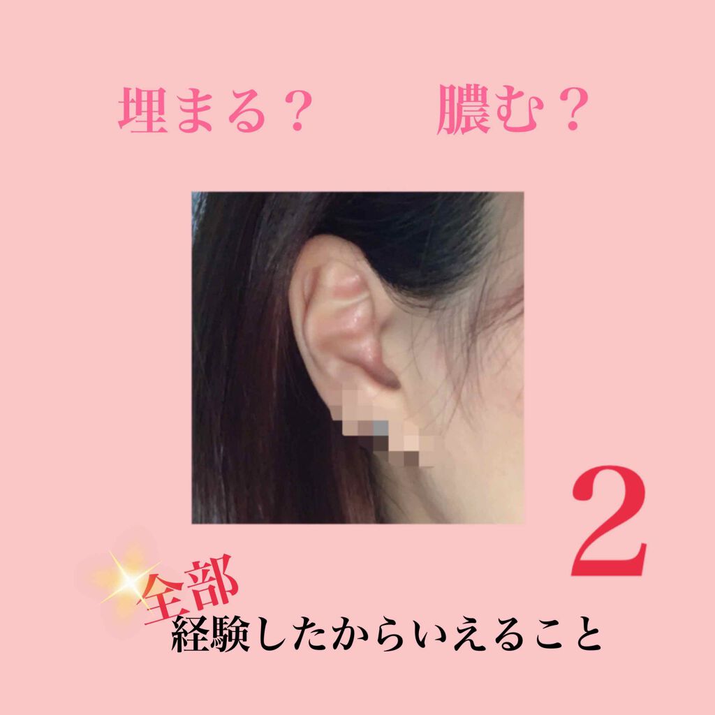 ドルマイシン軟膏(医薬品)/ゼリア新薬工業/その他を使ったクチコミ(1枚目)