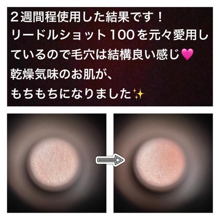 プロCICAリードルショット100/VT/ブースター・導入液を使ったクチコミ(6枚目)