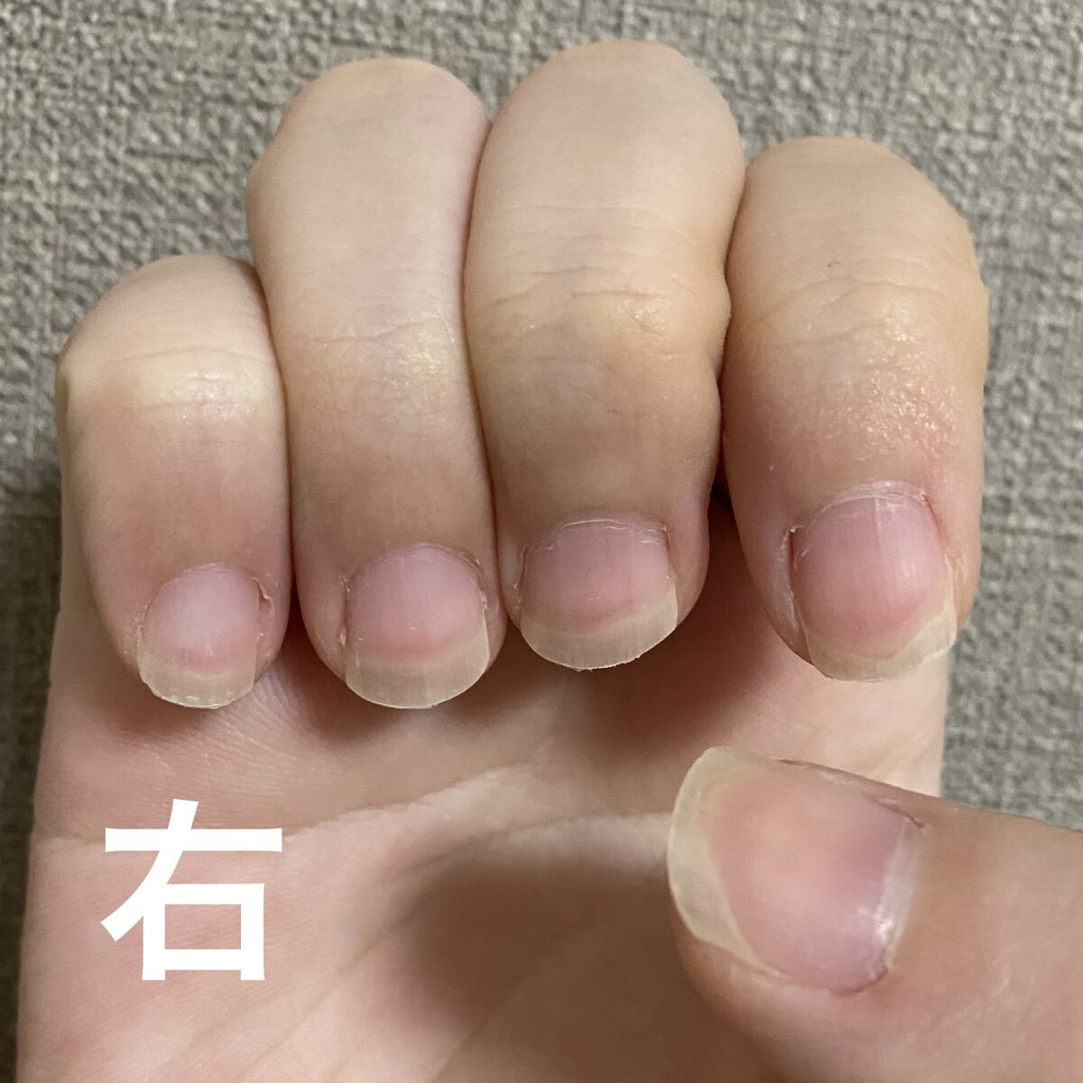 ネイルエンビー/O・P・I/ネイルオイル・トリートメントを使ったクチコミ（2枚目）