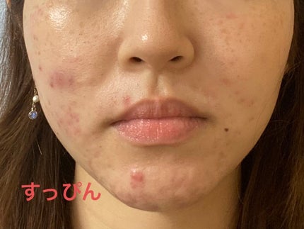 スターターキット(マット) #20/エトヴォス/トライアルキットの画像