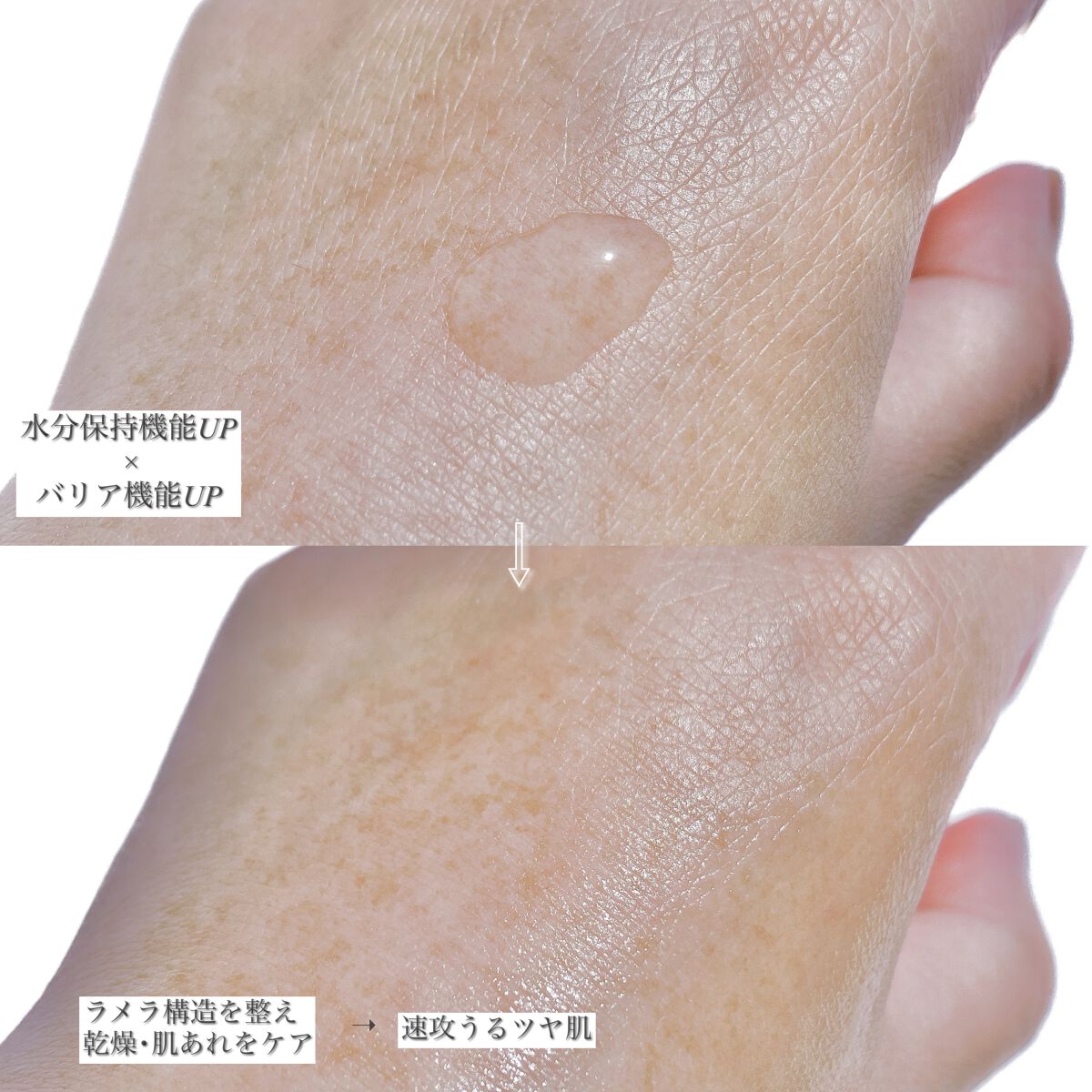 ヘパトリート 薬用保湿化粧水/ゼトックスタイル/化粧水を使ったクチコミ(2枚目)