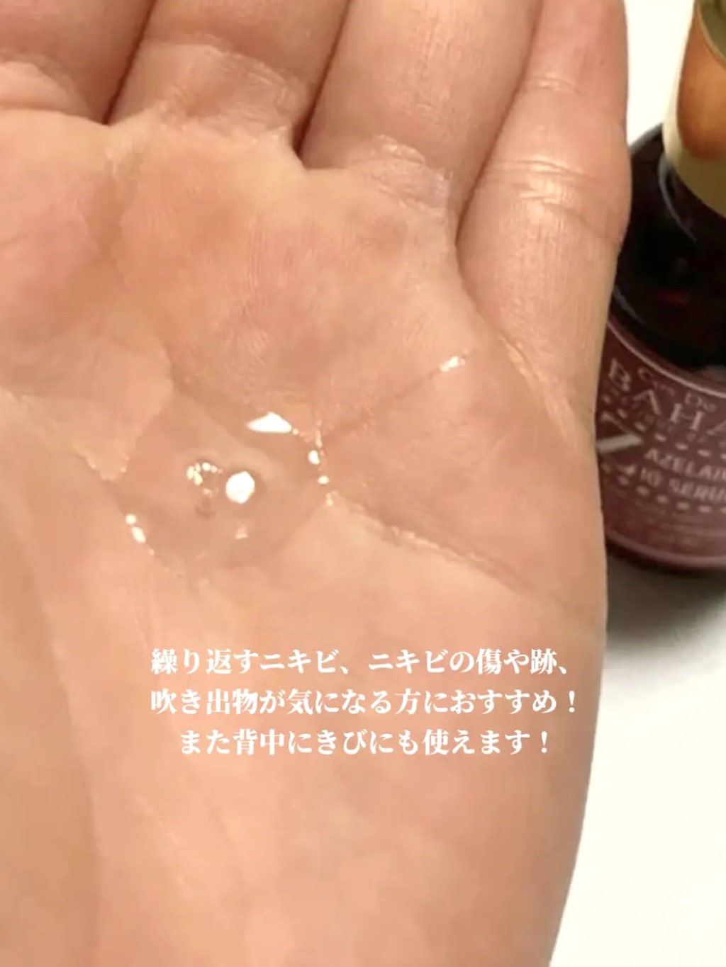 AZアゼライン酸10セラム/コスデバハ/美容液を使ったクチコミ（3枚目）