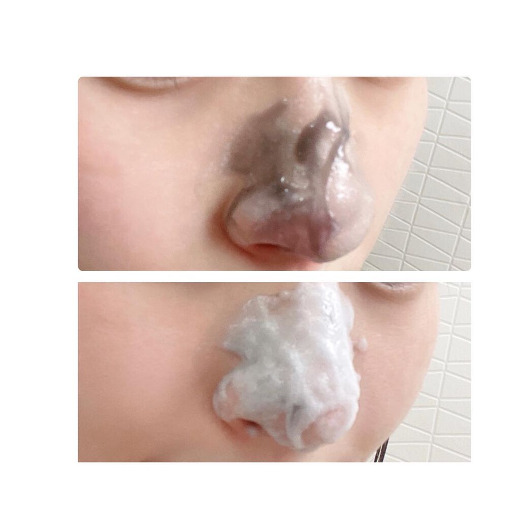 chika♡フォロバ100 on LIPS 「【JUSOKUROパック】.毛穴汚れ気になる”いちご鼻”に炭酸..」(4枚目)