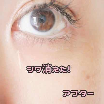 NANOA(ナノア) ヒト幹細胞美容液/NANOA/美容液を使ったクチコミ(1枚目)