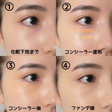 茶クマで悩む人必見 原因はコレ 今すぐできるケア方法やおすすめのアイテムを紹介 Lips 茶クマで悩む人必見 原因はコレ 今すぐできるケア方法やおすすめのアイテムを紹介 Lips