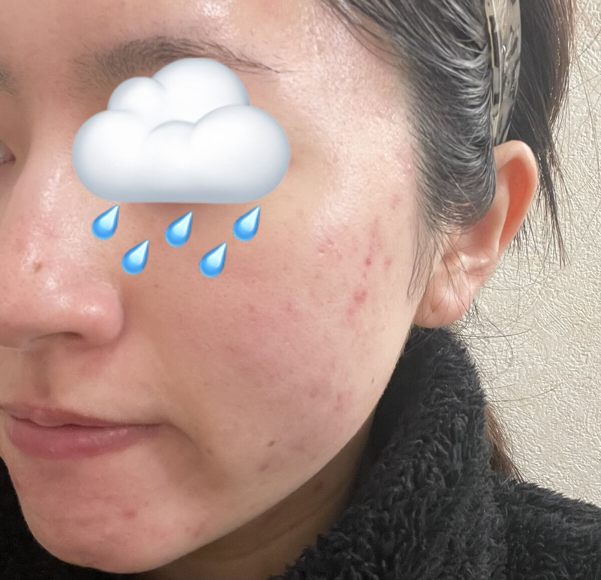 ハトムギエキス化粧水/プラチナレーベル/化粧水を使ったクチコミ（2枚目）