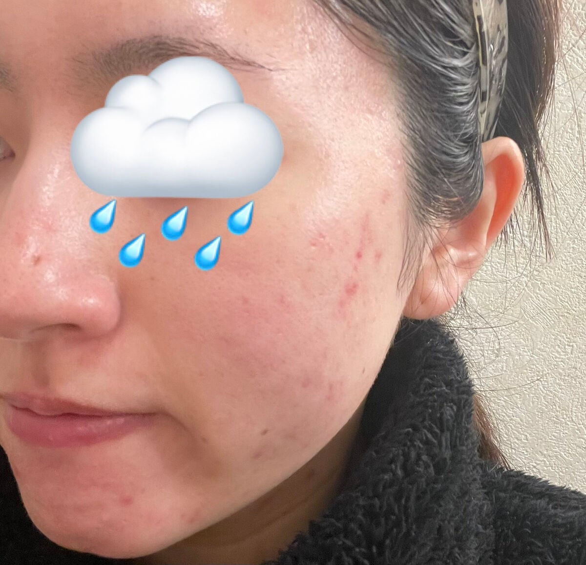 ハトムギエキス化粧水/プラチナレーベル/化粧水を使ったクチコミ(2枚目)