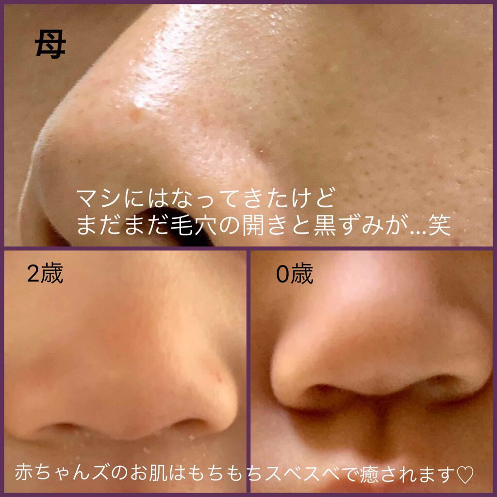 オールインワンシートマスク ホワイトEX/クオリティファースト/シートマスク・パックを使ったクチコミ（1枚目）