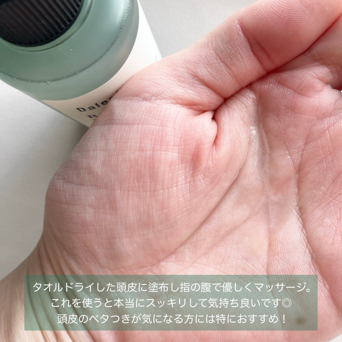 ベタールート ダンドラフ ヘアトニック/Daleaf/頭皮ローションを使ったクチコミ(2枚目)