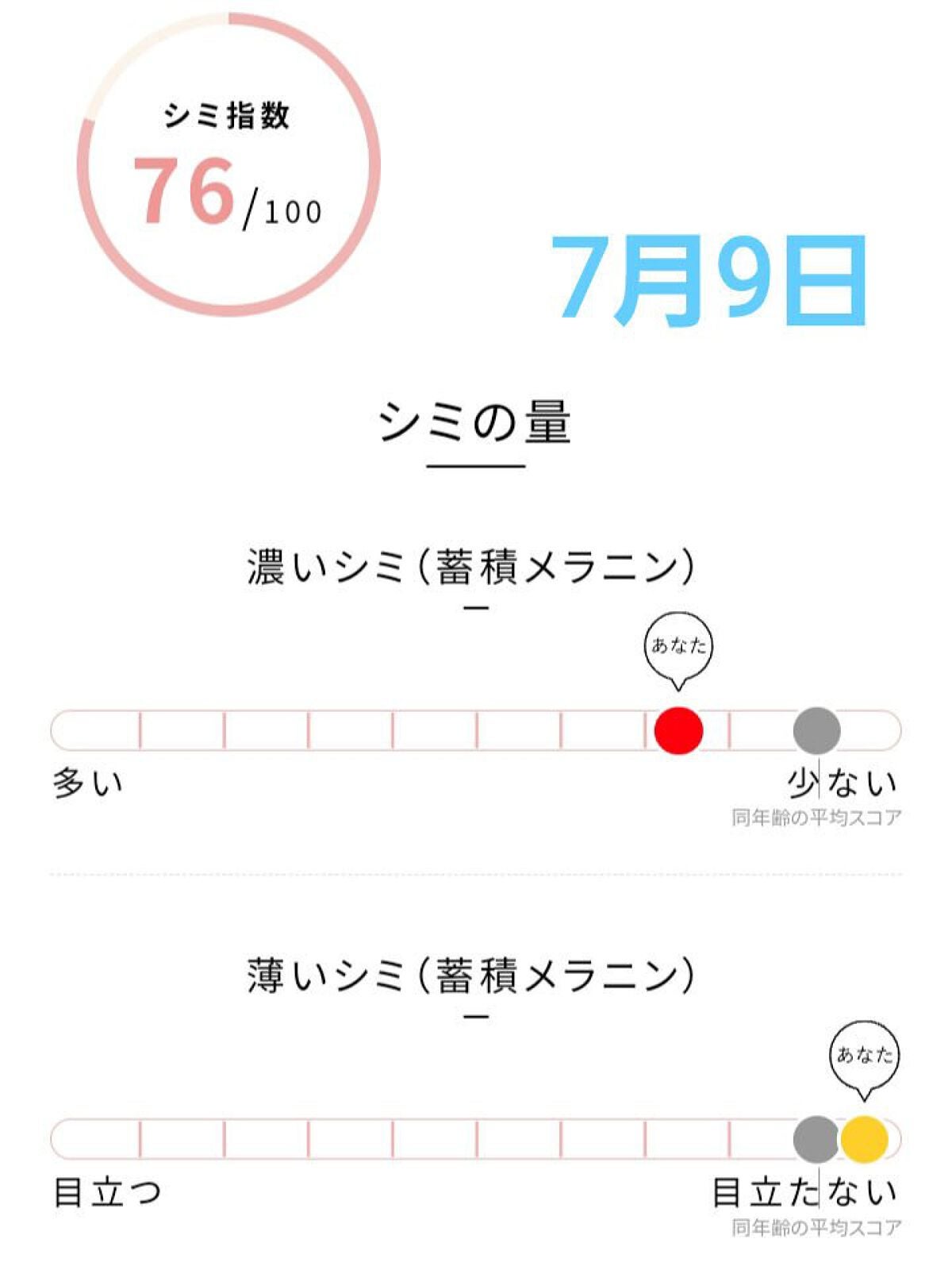 空良 on LIPS 「私、毎日肌診断してます!潤い、ハリ、シミ、くすみ…無料でカウン..」(4枚目)