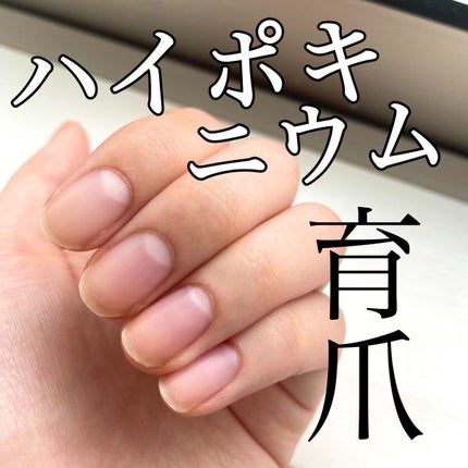 ユースキン/ユースキン/ボディクリームを使ったクチコミ(1枚目)