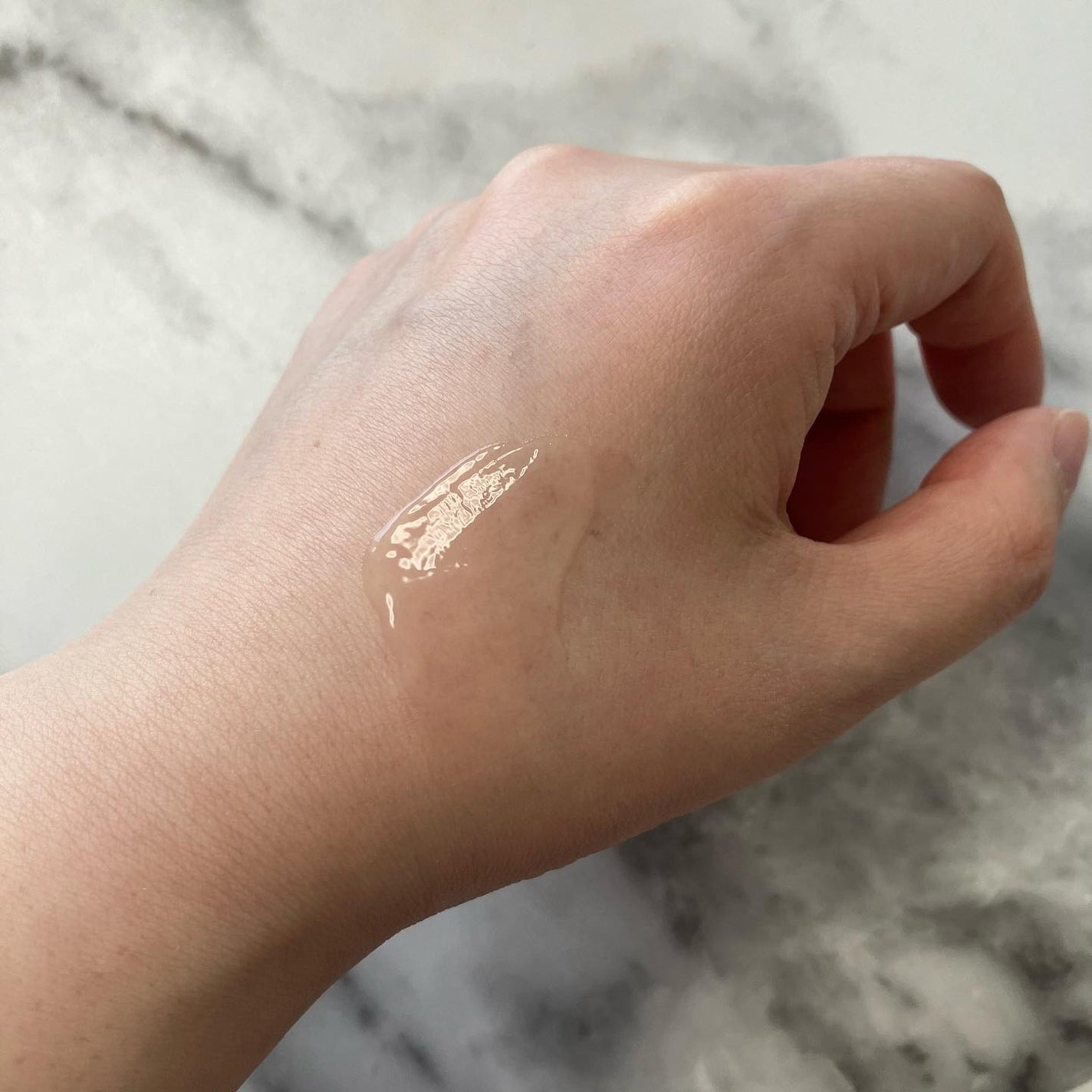 ニキビあとケアジェル/アットノン/その他スキンケアを使ったクチコミ(4枚目)