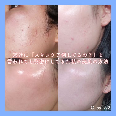 LANEIGE シカスリーピングマスクのクチコミ「「友達にスキンケア何してる？」と聞かれても

秘密にしていたスキンケアをお教えします！



.....」（1枚目）