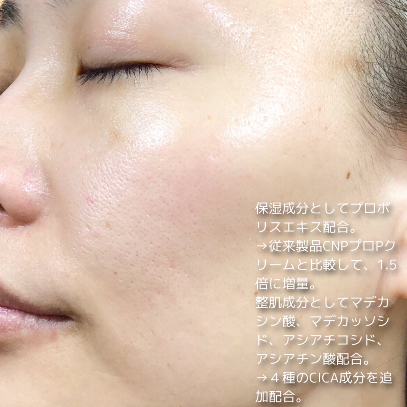 CNP プロP S クリーム/CNP Laboratory/フェイスクリームを使ったクチコミ(6枚目)
