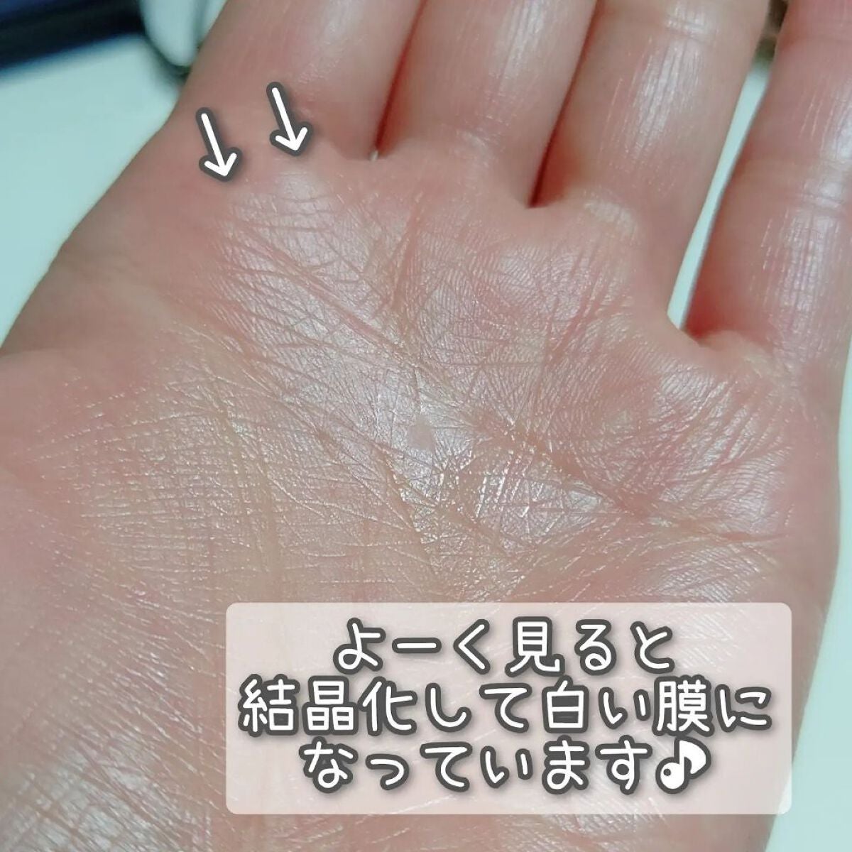 ナイアシンエッセンス/T’s/美容液を使ったクチコミ(5枚目)