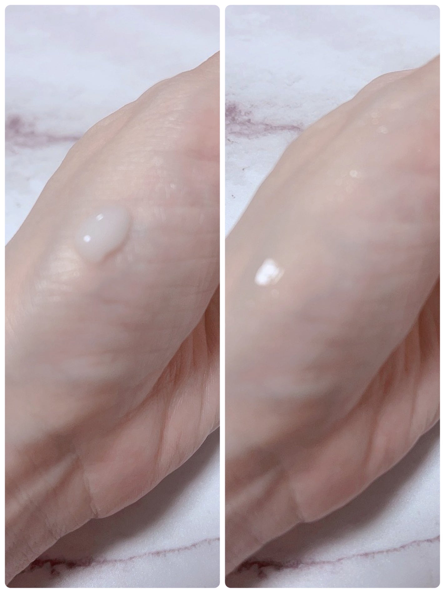 リードルショット300/VT/美容液を使ったクチコミ(2枚目)