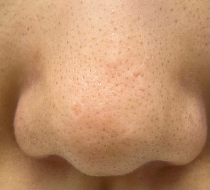 ムースネトワイアントCn/クレ・ド・ポー ボーテ/洗顔フォームを使ったクチコミ(5枚目)