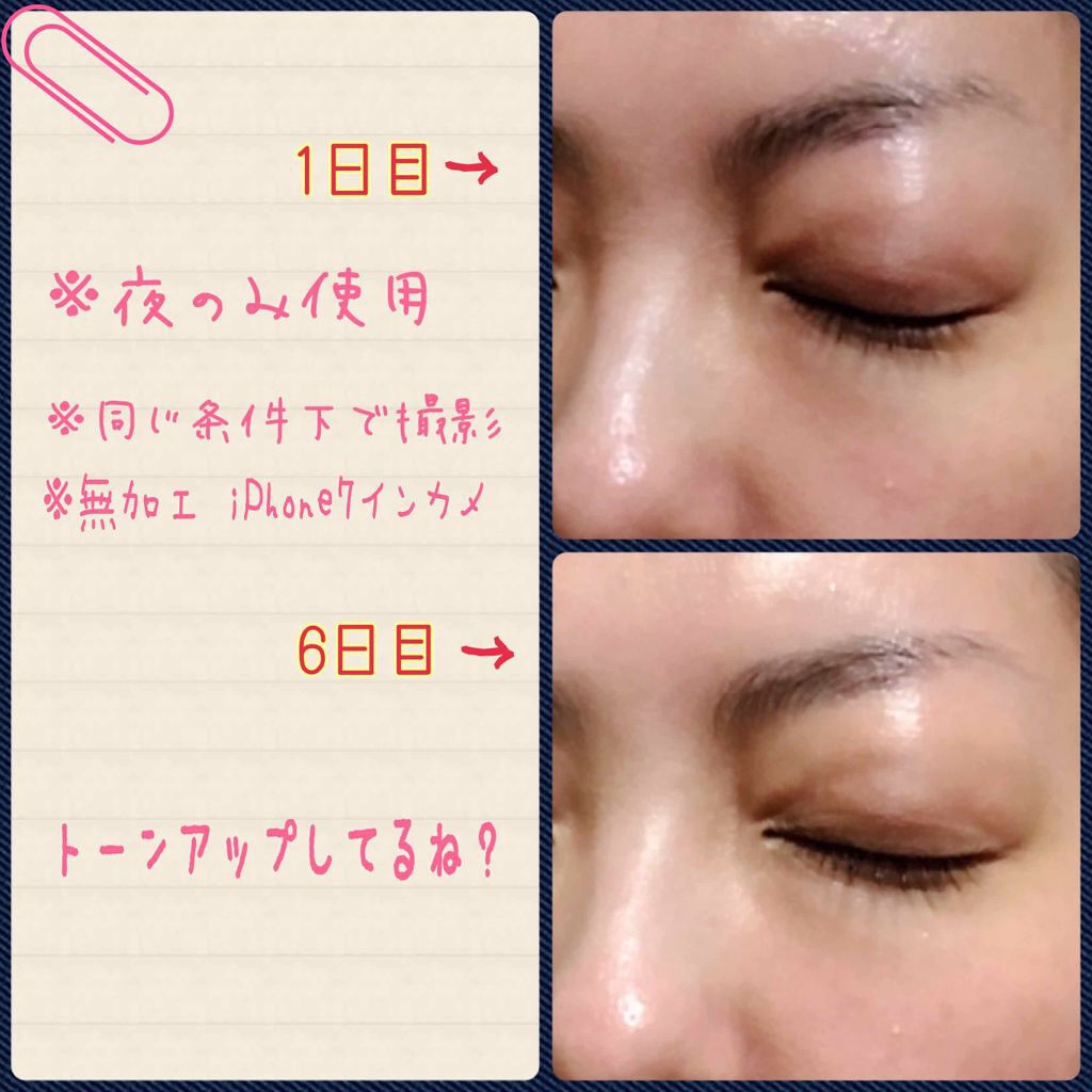 ルルルンプレシャス RED(三層保湿)/ルルルン/シートマスク・パックを使ったクチコミ(2枚目)