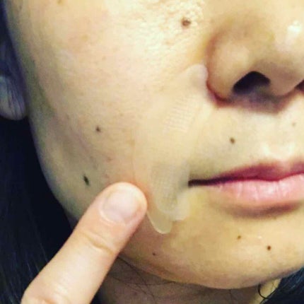 シロバリモイストパッチ/sirobari/シートマスク・パックを使ったクチコミ(6枚目)