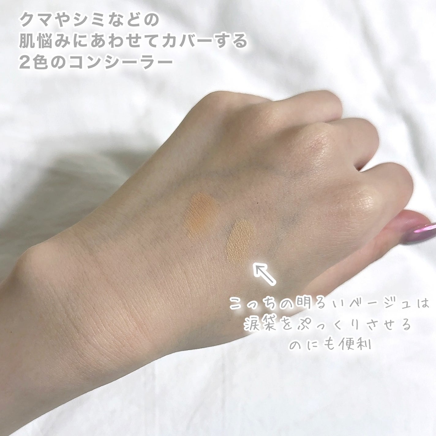 エテュセ スキンフィット カバーコンシーラー/ettusais/クリームコンシーラーを使ったクチコミ(3枚目)