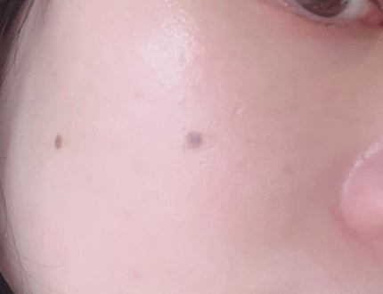 UVã€ã㢠XL ãããã¯ã·ã§ã³ããŒã³ã¢ãã ããŒãº+/ã© ããã·ã¥ ããŒ/æ¥çŒãæ¢ãã»UVã±ã¢ã䜿ã£ãã¯ãã³ãïŒ2æç®ïŒ