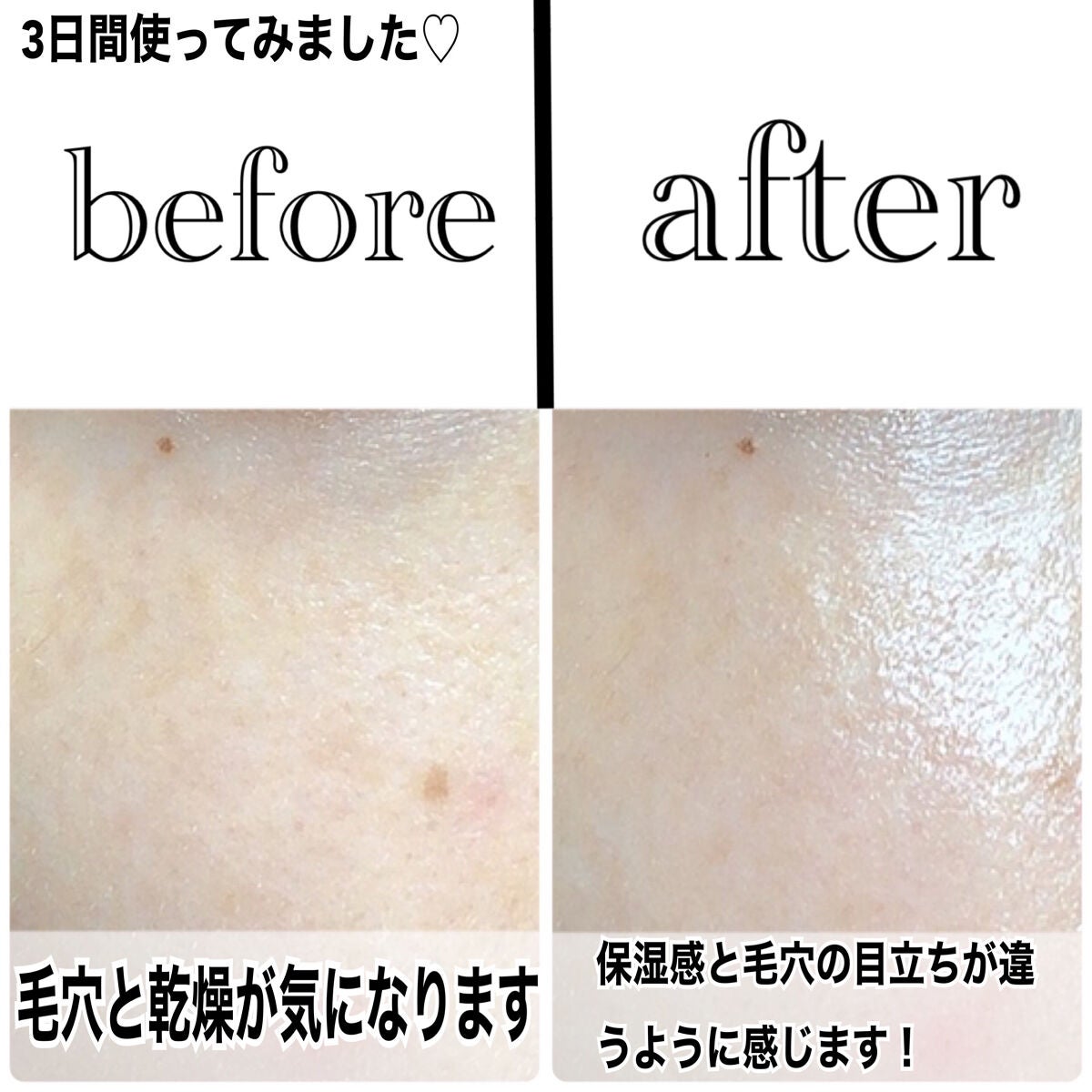 ダッチティーバランシングクリーム/MEDIPEEL/フェイスクリームを使ったクチコミ(6枚目)