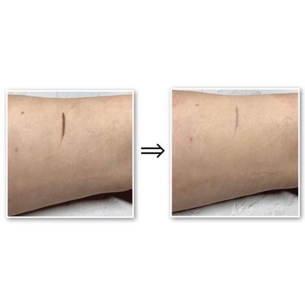 ロングラスティングコンシールフィクシングクッション /LUNA/クッションファンデーションを使ったクチコミ(6枚目)