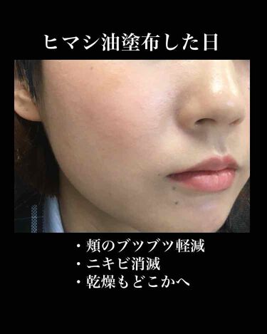 試してみた】精製キャスターオイル(ひまし油)/マンデイムーン | LIPS 直営特価の通販サイト 他 【ひまし油】温熱アンポ 化粧水/ローション