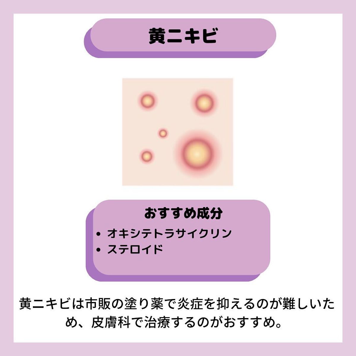ちゃも on LIPS 「こんにちはちゃもです🐱今回は、ニキビ別塗り薬の選び方のご紹介♪..」(4枚目)