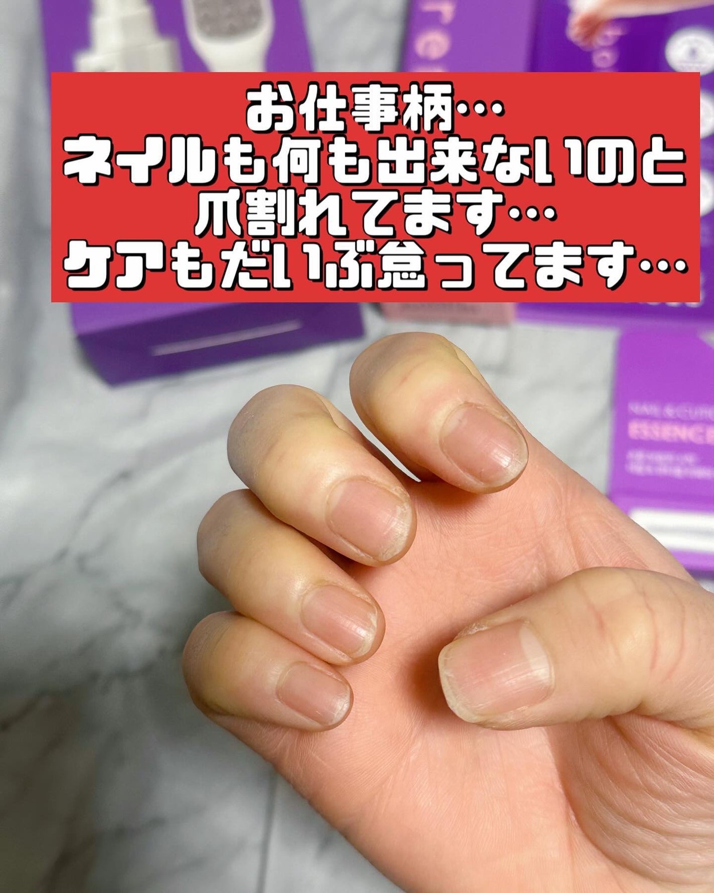 ネイル&キューティクルケアエッセンスオイルペン/BAREN/ネイルオイル・トリートメントを使ったクチコミ(4枚目)