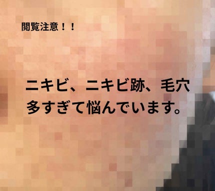 乳液・敏感肌用・しっとりタイプ/無印良品/乳液を使ったクチコミ(1枚目)