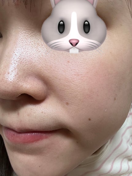 モデリングカップパック クールティーツリー/LINDSAY/洗い流すパック・マスクを使ったクチコミ(8枚目)