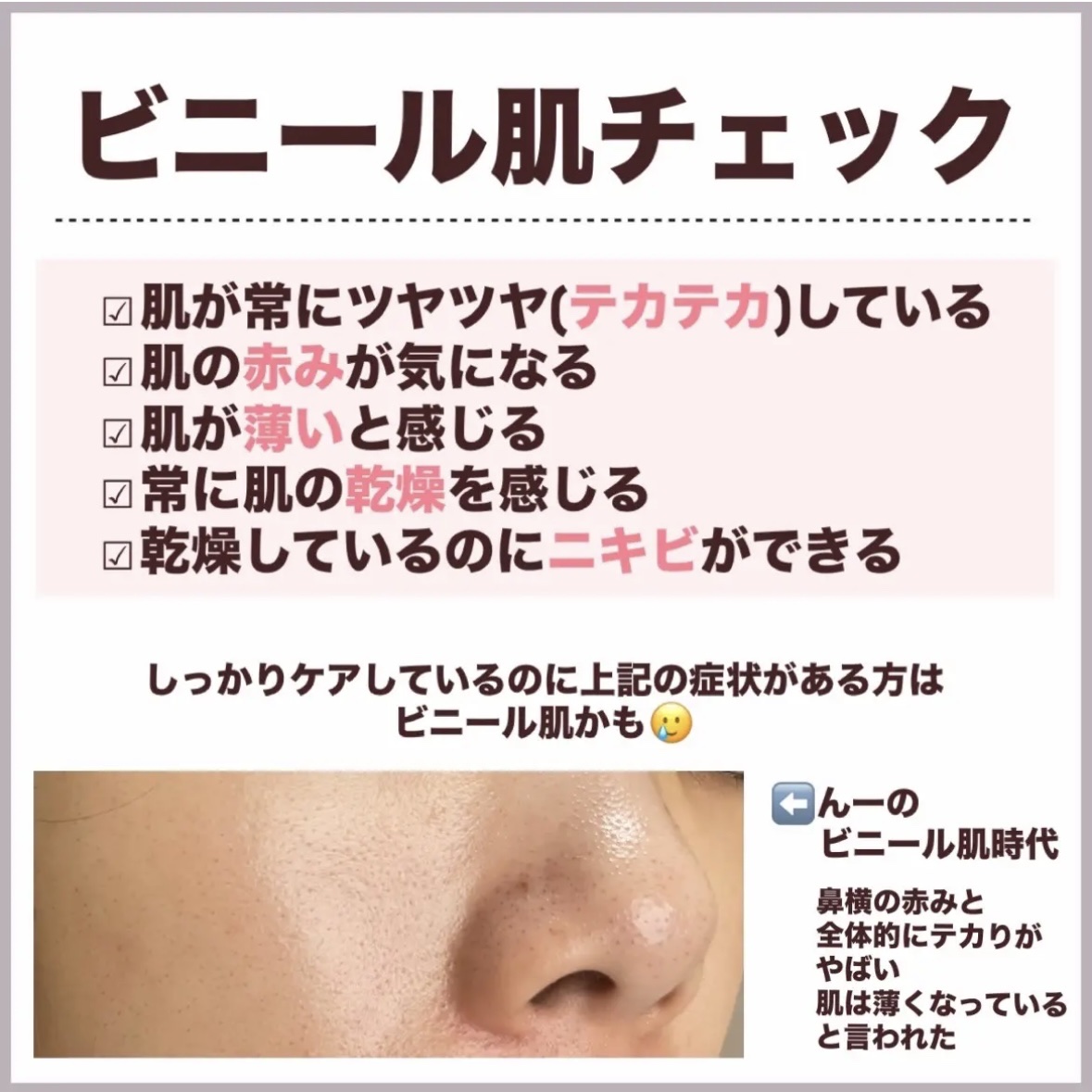 泡の洗顔料/カウブランド無添加/泡洗顔を使ったクチコミ（3枚目）