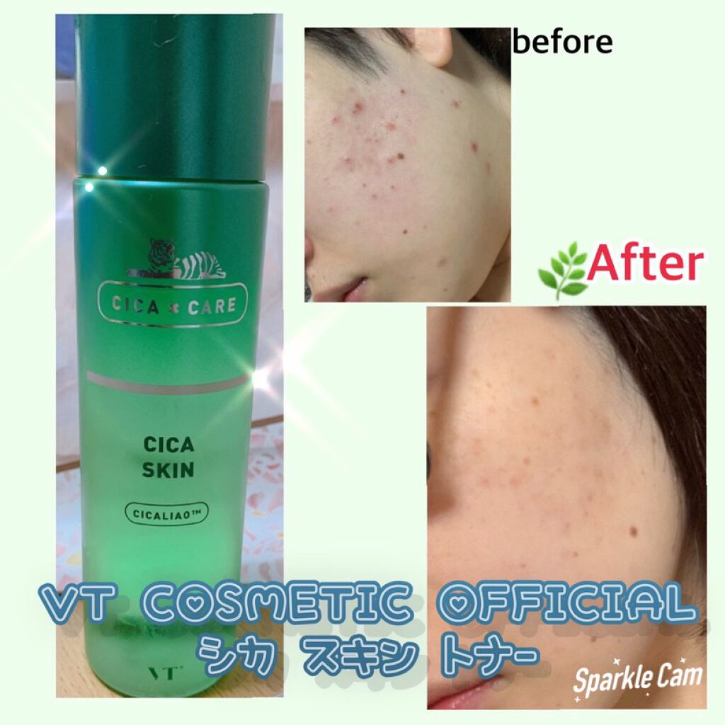 CICA スキン/VT/化粧水を使ったクチコミ(1枚目)