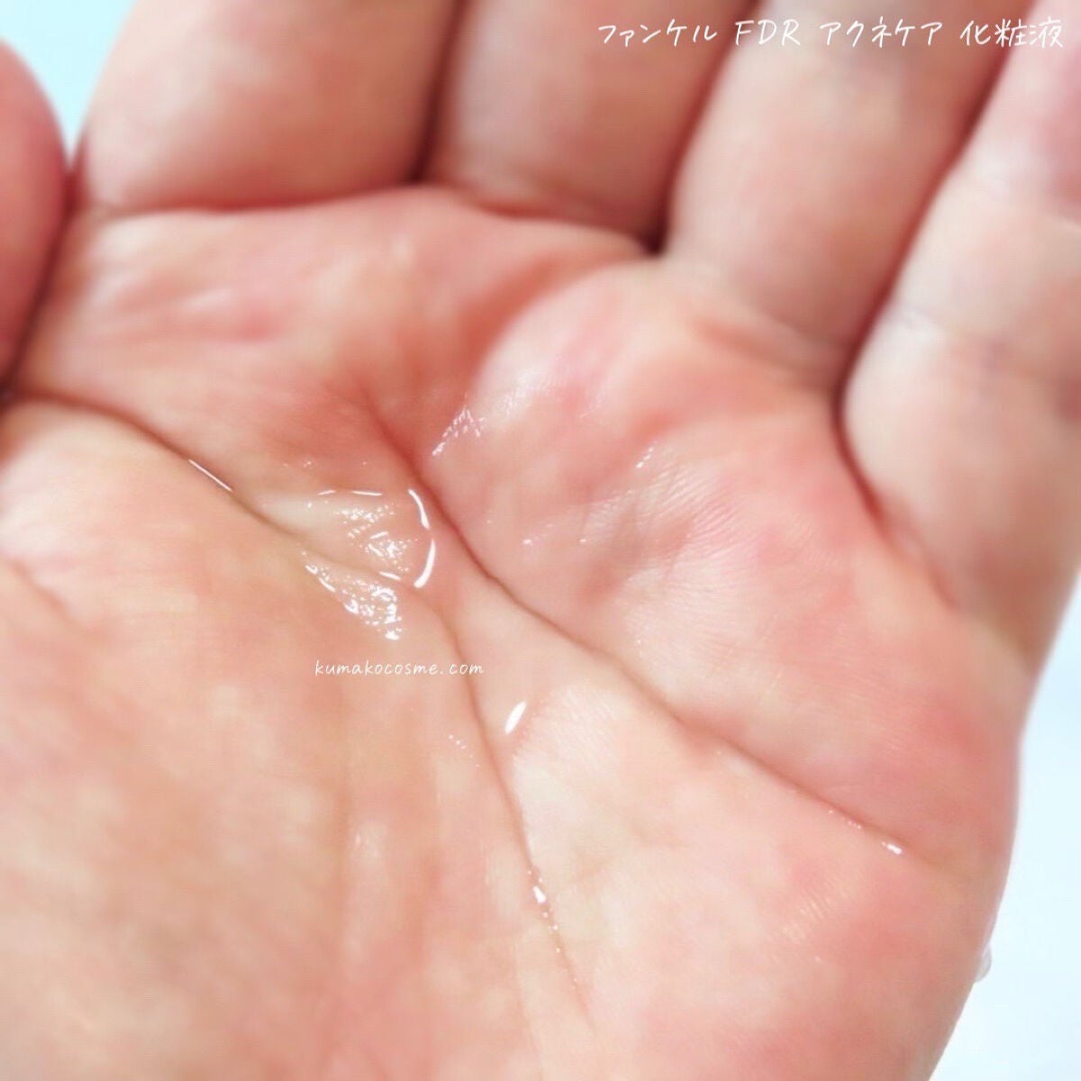 アクネケア 化粧液 <医薬部外品>/ファンケル/化粧水を使ったクチコミ(4枚目)