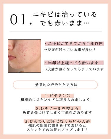 grandis.［ ｸﾞﾗﾝﾃﾞｨ ］｜フォロバ100🌱 on LIPS 「👈かわいいコスメや最新スキンケア情報はこちらから❣️今日は症状..」（3枚目）