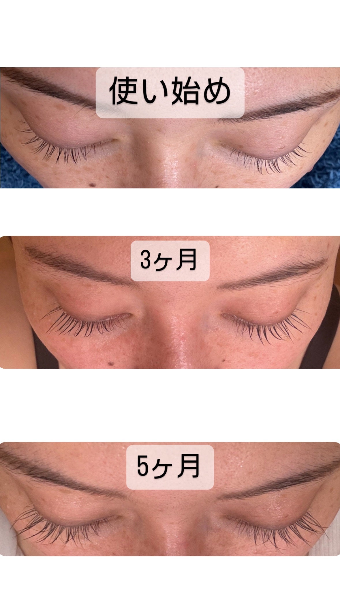 エグータム/アルマダスタイル/まつげ美容液を使ったクチコミ(1枚目)