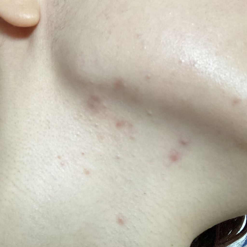 オードムーゲ 薬用ローション（ふきとり化粧水）/オードムーゲ/拭き取り化粧水を使ったクチコミ（3枚目）