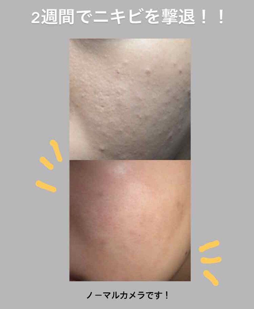 を使ったクチコミ（1枚目）