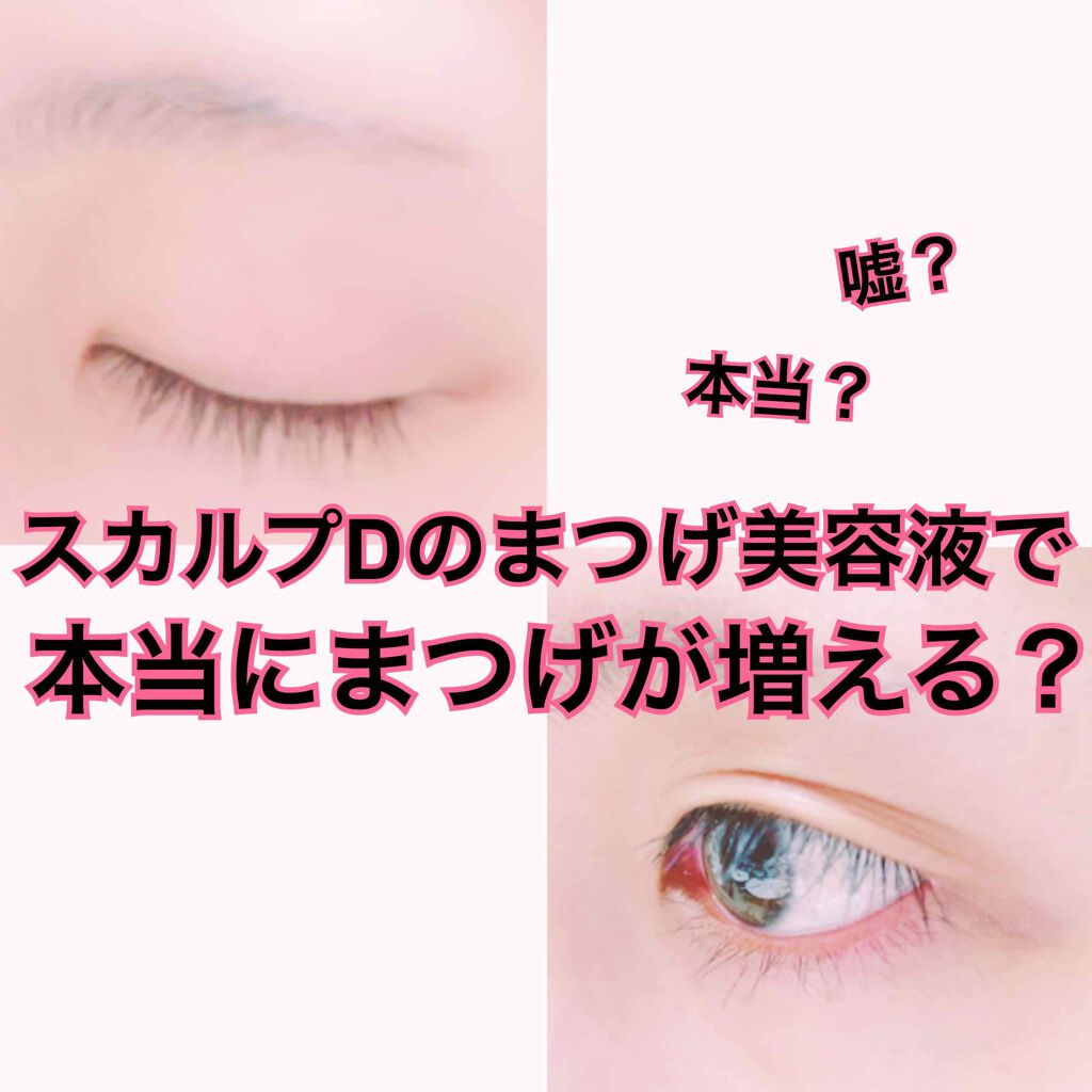 スカルプD ボーテ ピュアフリーアイラッシュセラム/アンファー(スカルプD)/まつげ美容液を使ったクチコミ（1枚目）