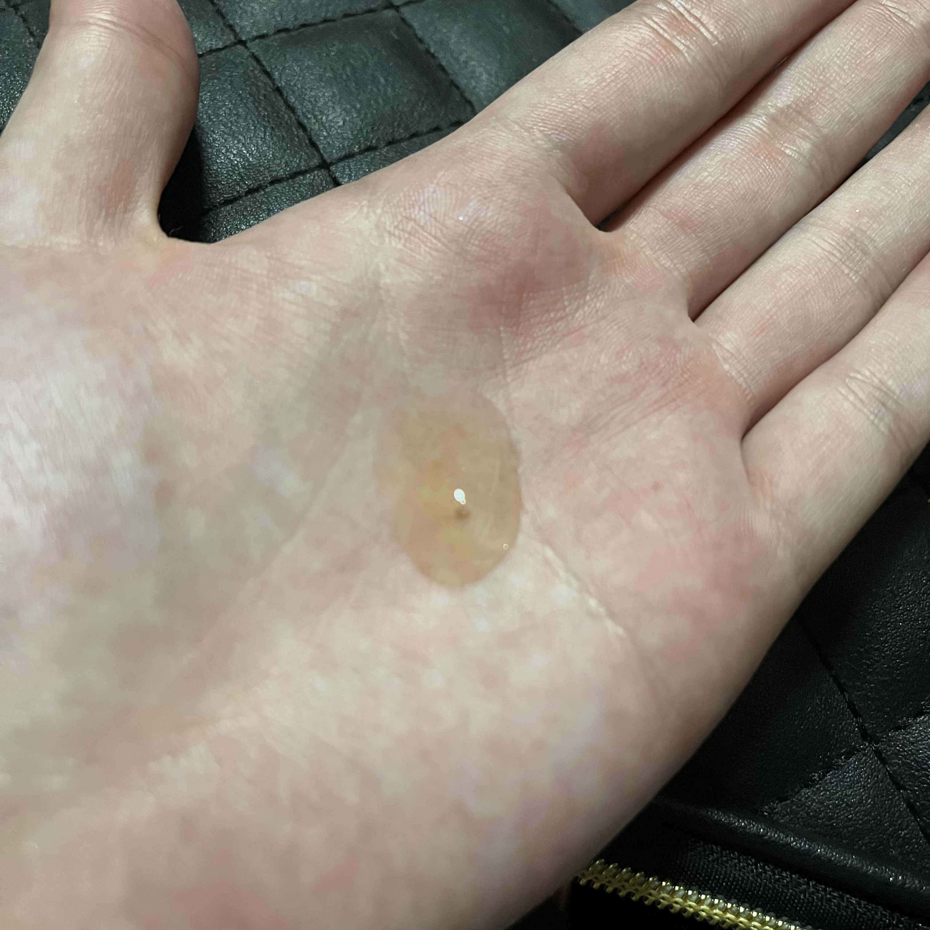 シカテロル美容液/beplain/美容液を使ったクチコミ（2枚目）