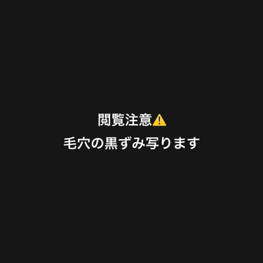 よんちょる on LIPS 「割とガチめに助けてください。最近スキンケアとかサボってたりして..」（1枚目）