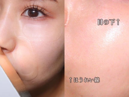 ゴールドコラーゲンニードルパッチ/SNP/アイケア・アイクリームを使ったクチコミ(2枚目)