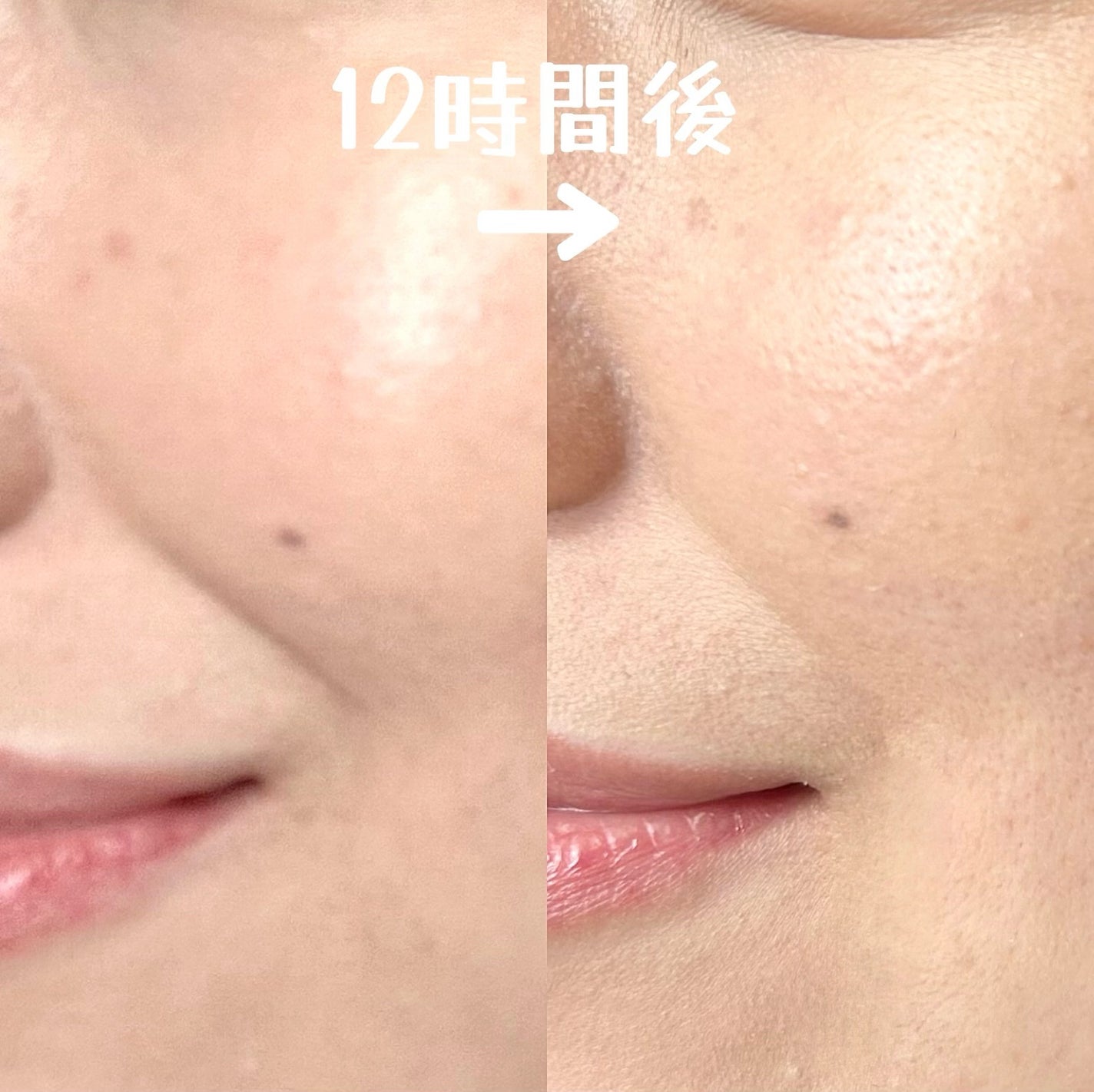 ピンクティーツリーカバープライマークッション/APLIN/クッションファンデーションを使ったクチコミ(5枚目)