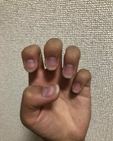 ネイルベッドオイル/アンドネイル/ネイルオイル・トリートメントを使ったクチコミ(1枚目)