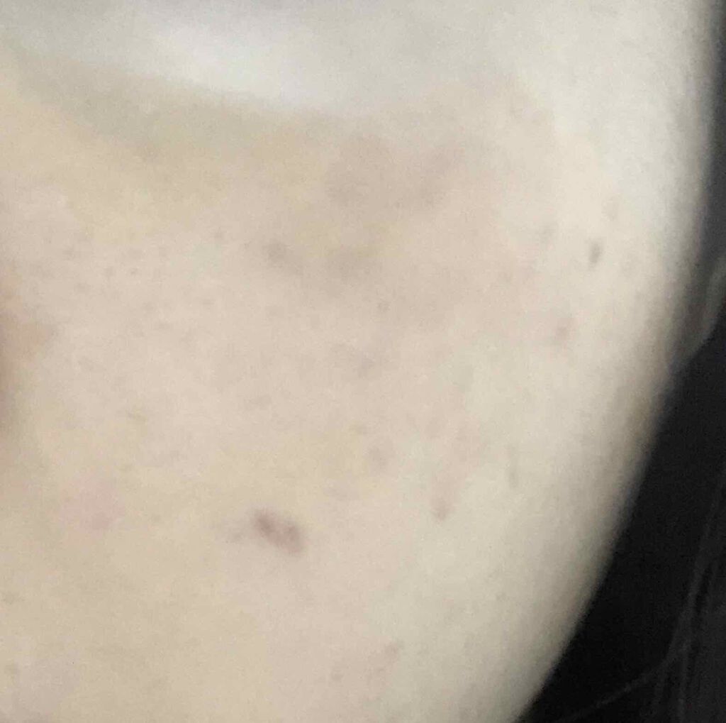 ザ コンシーラー/MISSHA/リキッドコンシーラーを使ったクチコミ（3枚目）